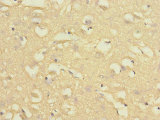 Immunohistochemistry of paraffin-embedded human brain tissue using CSB-PA015821DSR1HU at dilution of 1:100