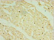 Immunohistochemistry of paraffin-embedded human myocardium tissue using CSB-PA015845ESR1HU at dilution of 1:100