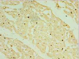 Immunohistochemistry of paraffin-embedded human myocardium tissue using CSB-PA015845ESR1HU at dilution of 1:100