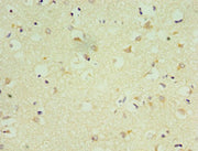 Immunohistochemistry of paraffin-embedded human brain tissue using CSB-PA015845ESR2HU at dilution of 1:100