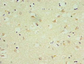 Immunohistochemistry of paraffin-embedded human brain tissue using CSB-PA015845ESR2HU at dilution of 1:100