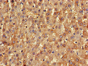 Immunohistochemistry of paraffin-embedded human liver tissue using CSB-PA015878LA01HU at dilution of 1:100