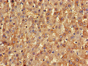 Immunohistochemistry of paraffin-embedded human liver tissue using CSB-PA015878LA01HU at dilution of 1:100