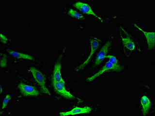 Immunofluorescent analysis of Hela cells using CSB-PA015890LA01HU at dilution of 1:100 and Alexa Fluor 488-congugated AffiniPure Goat Anti-Rabbit IgG(H+L)