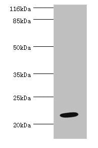 Western blot All lanes: NME6 antibody at 2µg/ml + Hela whole cell lysate Secondary Goat polyclonal to rabbit IgG at 1/10000 dilution Predicted band size: 22, 14, 19 kDa Observed band size: 22 kDa