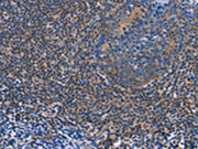 The image on the left is immunohistochemistry of paraffin-embedded Human tonsil tissue using CSB-PA015892(AGFG1 Antibody) at dilution 1/60, on the right is treated with fusion protein. (Original magnification: ×200)