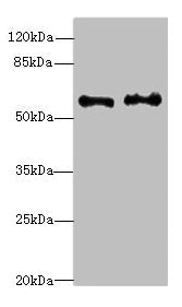 Western blot All lanes: NMT2 antibody at 4.99ug/ml Lane 1: Human placenta tissue Lane 2: K562 whole cell lysate Secondary Goat polyclonal to rabbit IgG at 1/10000 dilution Predicted band size: 57 kDa Observed band size: 57 kDa