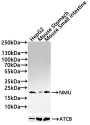 Western Blot Positive WB detected in: HepG2 whole cell lysate(30µg),Mouse Stomach tissue lysate(30µg),Mouse Small intestine tissue lysate(30µg) All lanes: NMU antibody at 1:1000 Secondary Goat polyclonal to rabbit IgG at 1/20000 dilution Predicted...