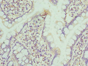 Immunohistochemistry of paraffin-embedded human small intestine tissue using CSB-PA015902ESR2HU at dilution of 1:100