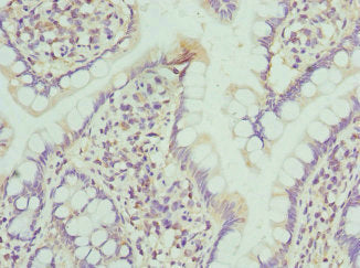 Immunohistochemistry of paraffin-embedded human small intestine tissue using CSB-PA015902ESR2HU at dilution of 1:100