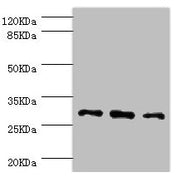Western blot All lanes: NNMT antibody at 2.47µg/ml Lane 1: HepG2 whole cell lysate Lane 2: Hela whole cell lysate Lane 3: A549 whole cell lysate Secondary Goat polyclonal to rabbit IgG at 1/10000 dilution Predicted band size: 30 kDa Observed band...