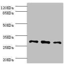 Western blot All lanes: NNMT antibody at 2.47µg/ml Lane 1: HepG2 whole cell lysate Lane 2: Hela whole cell lysate Lane 3: A549 whole cell lysate Secondary Goat polyclonal to rabbit IgG at 1/10000 dilution Predicted band size: 30 kDa Observed band...
