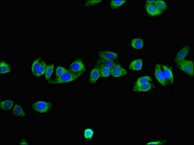 Immunofluorescent analysis of HepG2 cells using CSB-PA015906LA01HU at dilution of 1:100 and Alexa Fluor 488-congugated AffiniPure Goat Anti-Rabbit IgG(H+L)