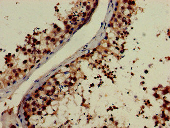 Immunohistochemistry of paraffin-embedded human testis tissue using CSB-PA015917LA01HU at dilution of 1:100