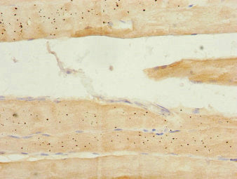 Immunohistochemistry of paraffin-embedded human skeletal muscle tissue using CSB-PA015921DSR2HU at dilution of 1:100