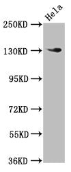 Western Blot Positive WB detected in: Hela whole cell lysate All lanes: NOMO1 antibody at 3µg/ml Secondary Goat polyclonal to rabbit IgG at 1/50000 dilution Predicted band size: 135 kDa Observed band size: 135 kDa