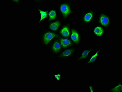 Immunofluorescence staining of A549 cells with CSB-PA015943LA01HU at 1:166, counter-stained with DAPI. The cells were fixed in 4% formaldehyde, permeabilized using 0.2% Triton X-100 and blocked in 10% normal Goat Serum. The cells were then incubat...