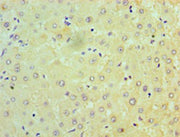 Immunohistochemistry of paraffin-embedded human liver tissue using CSB-PA01594A0Rb at dilution of 1:100
