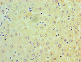 Immunohistochemistry of paraffin-embedded human liver tissue using CSB-PA01594A0Rb at dilution of 1:100