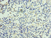 Immunohistochemistry of paraffin-embedded human thymus tissue using CSB-PA015956ESR2HU at dilution of 1:100