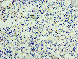Immunohistochemistry of paraffin-embedded human thymus tissue using CSB-PA015956ESR2HU at dilution of 1:100