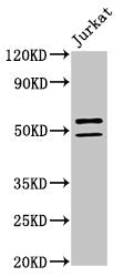 Western Blot Positive WB detected in: Jurkat whole cell lysate All lanes: NOVA1 antibody at 2µg/ml Secondary Goat polyclonal to rabbit IgG at 1/50000 dilution Predicted band size: 53, 20, 50, 52 kDa Observed band size: 53, 50 kDa