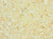 Immunohistochemistry of paraffin-embedded human liver tissue using CSB-PA015960ESR1HU at dilution of 1:100