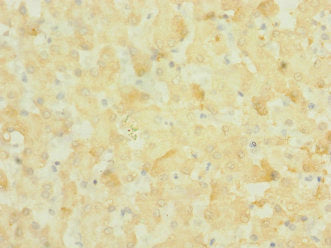 Immunohistochemistry of paraffin-embedded human liver tissue using CSB-PA015960ESR1HU at dilution of 1:100