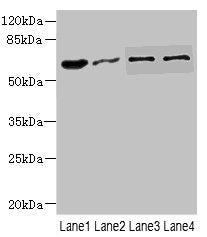 Western blot All lanes: NOX3antibody at 0.96ug/ml Lane 1: Mouse kidney tissue Lane 2: 293T whole cell lysate Lane 3: HepG2 whole cell lysate Lane 4: Hela whole cell lysate Secondary Goat polyclonal to rabbit IgG at 1/10000 dilution Predicted band...