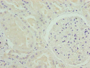 Immunohistochemistry of paraffin-embedded human kidney tissue using CSB-PA015961LA01HU at dilution of 1:100