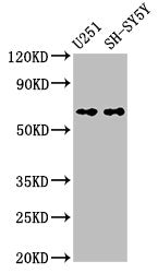 Western Blot Positive WB detected in: U251 whole cell lysate, SH-SY5Y whole cell lysate All lanes: Nox4 antibody at 3.3µg/ml Secondary Goat polyclonal to rabbit IgG at 1/50000 dilution Predicted band size: 67 kDa Observed band size: 67 kDa