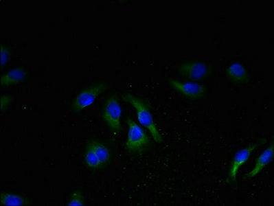 Immunofluorescent analysis of A549 cells using CSB-PA015973LA01HU at dilution of 1:100 and Alexa Fluor 488-congugated AffiniPure Goat Anti-Rabbit IgG(H+L)