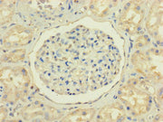 Immunohistochemistry of paraffin-embedded human kidney tissue using CSB-PA015976LA01HU at dilution of 1:100