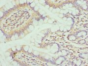 Immunohistochemistry of paraffin-embedded human small intestine tissue using CSB-PA015981ESR2HU at dilution of 1:100