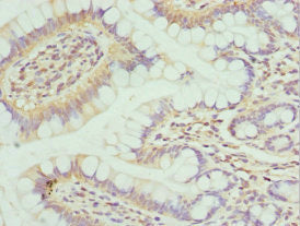 Immunohistochemistry of paraffin-embedded human small intestine tissue using CSB-PA015981ESR2HU at dilution of 1:100