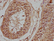 IHC image of CSB-PA015983NA01HU diluted at 1:500 and staining in paraffin-embedded human testis tissue performed on a Leica BondTM system. After dewaxing and hydration, antigen retrieval was mediated by high pressure in a citrate buffer (pH 6.0)....
