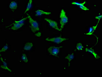 Immunofluorescence staining of U251 cells with CSB-PA015983OA01HU at 1:50, counter-stained with DAPI. The cells were fixed in 4% formaldehyde, permeabilized using 0.2% Triton X-100 and blocked in 10% normal Goat Serum. The cells were then incubate...