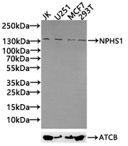 Positive WB detected in: JK whole cell lysate30µg), U251 whole cell lysate(30µg), MCF7 whole cell lysate(30µg), 293T whole cell lysate(30µg) All lanes: NPHS1 antibody at 1:1000 Secondary Goat polyclonal to rabbit IgG at 1/50000 dilution Predicted...