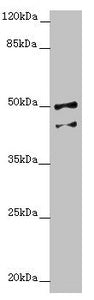 Western blot All lanes: NPTN antibody at 4.37 ug/ml + Hela whole cell lysate Secondary Goat polyclonal to rabbit IgG at 1/10000 dilution Predicted band size: 45, 32, 31, 38, 44 kDa Observed band size: 45, 50 kDa