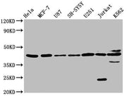 Western Blot Positive WB detected in: Hela whole cell lysate, MCF-7 whole cell lysate, U87 whole cell lysate, SH-SY5Y whole cell lysate, U251 whole cell lysate, Jurkat whole cell lysate, K562 whole cell lysate All lanes: NPY2R antibody at 3.2µg/ml...