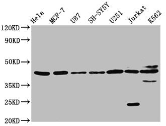 Western Blot Positive WB detected in: Hela whole cell lysate, MCF-7 whole cell lysate, U87 whole cell lysate, SH-SY5Y whole cell lysate, U251 whole cell lysate, Jurkat whole cell lysate, K562 whole cell lysate All lanes: NPY2R antibody at 3.2µg/ml...