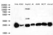 Western Blot Positive WB detected in: Hela whole cell lysate, K562 whole cell lysate, HepG2 whole cell lysate, JK whole cell lysate, A549 whole cell lysate, MCF7 whole cell lysate, ntera2 whole cell lysate All lanes:NQO2 Antibody at 1:1000 Seconda...