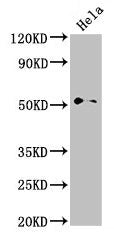 Western Blot Positive WB detected in: Hela whole cell lysate All lanes: NR0B1 antibody at 2.8µg/ml Secondary Goat polyclonal to rabbit IgG at 1/50000 dilution Predicted band size: 52, 44 kDa Observed band size: 52 kDa