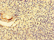 Immunohistochemistry of paraffin-embedded human spleen tissue using CSB-PA016043LA01HU at dilution of 1:100