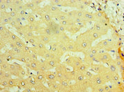 Immunohistochemistry of paraffin-embedded human liver tissue using CSB-PA016048ESR1HU at dilution of 1:100