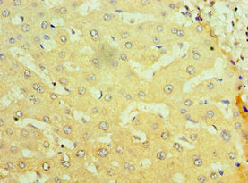 Immunohistochemistry of paraffin-embedded human liver tissue using CSB-PA016048ESR1HU at dilution of 1:100