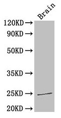 Western Blot Positive WB detected in: Mouse brain tissue All lanes: HMGB1 antibody at 3.3µg/ml Secondary Goat polyclonal to rabbit IgG at 1/50000 dilution Predicted band size: 25 kDa Observed band size: 25 kDa