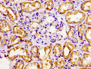 Immunohistochemistry of paraffin-embedded human kidney tissue using CSB-PA016058LA01HU at dilution of 1:100