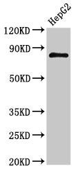 Western Blot Positive WB detected in: HepG2 whole cell lysate All lanes: NR3C1 antibody at 3µg/ml Secondary Goat polyclonal to rabbit IgG at 1/50000 dilution Predicted band size: 86, 82, 65, 61, 83, 79, 77, 76, 52, 51, 50 kDa Observed band size: 8...