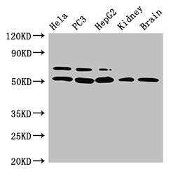 Western Blot Positive WB detected in: Hela whole cell lysate, PC-3 whole cell lysate, HepG2 whole cell lysate, Mouse kidney tissue, Mouse brain tissue All lanes: NR5A2 antibody at 3ug/ml Secondary Goat polyclonal to rabbit IgG at 1/50000 dilution...